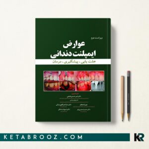 کتاب عوارض ایمپلنت دندانی