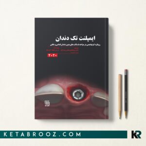 ایمپلنت تک دندان 2020