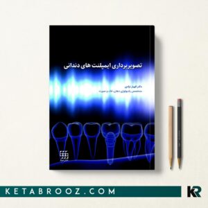 تصویربرداری ایمپلنت های دندانی