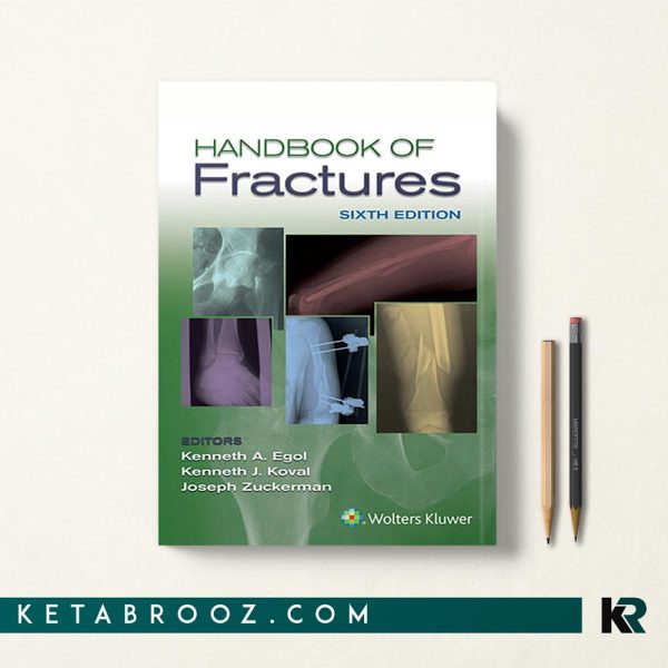 کتاب Handbook of Fractures کتابچه راهنمای شکستگی ها