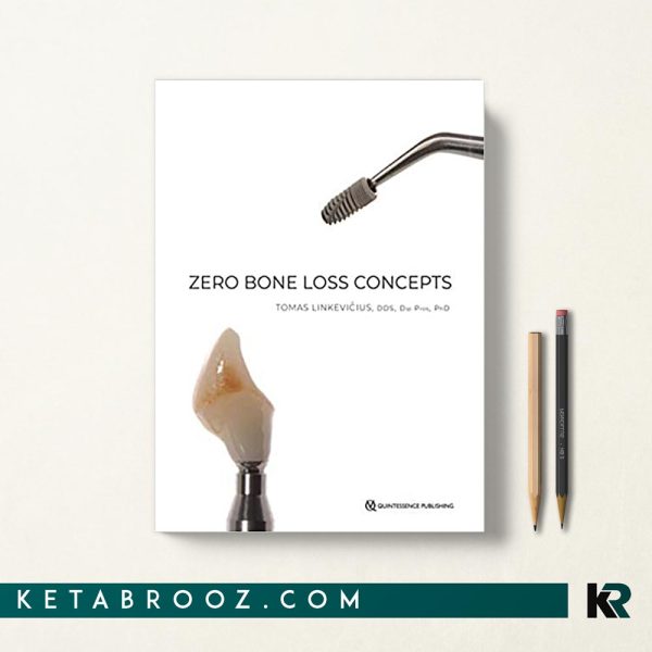 Zero Bone Loss Concepts مفاهیم صفر از دست دادن استخوان