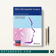 Mohs Micrographic Surgery جراحی میکروگرافی موهز