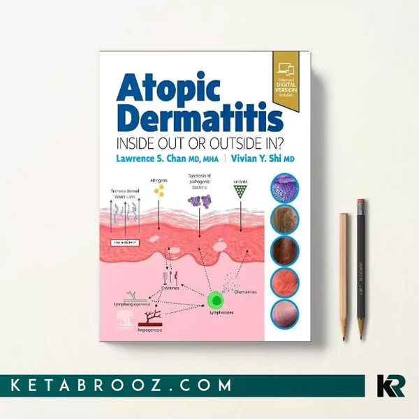 کتاب Atopic Dermatitis اثر Lawrence S Chan زبان اصلی
