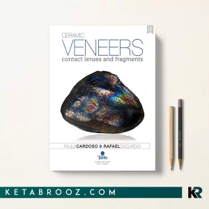 کتاب Ceramic veneers contact lenses and fragments