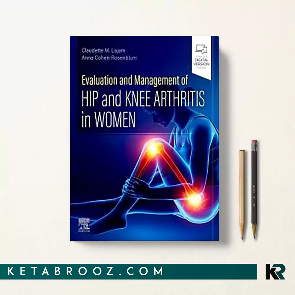 کتاب Evaluation and Management of Hip and Knee Arthritis in Women
