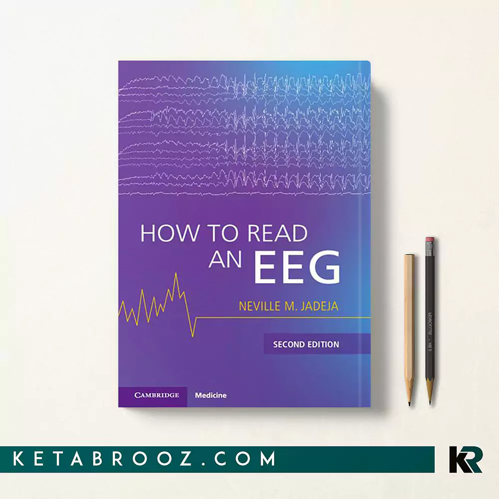 کتاب How to Read an EEG