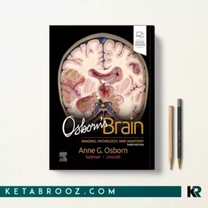 کتاب Osborn's Brain اثر Anne G. Osborn زبان اصلی