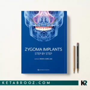 کتاب Zygoma Implants اثر Arun K. Garg زبان اصلی